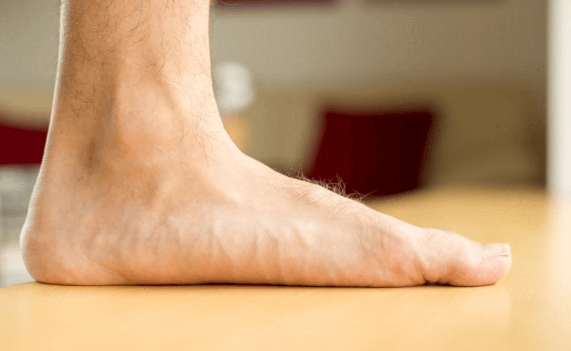 That Pain in Your Knees and Lower Back Could Be Linked to Your Feet and  Poor Foot Support!