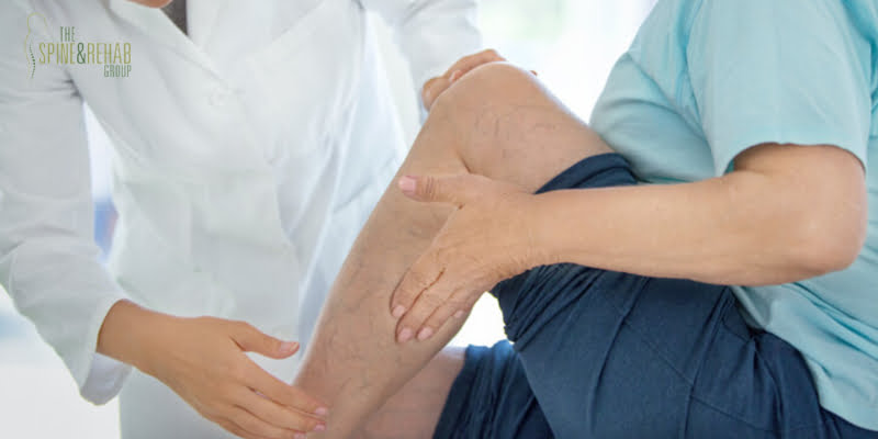 Closeup side view of female doctor massaging legs and calves of a senior female patient with visible varicose veins