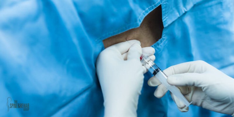 Doctor injects epidural steroid injection into a patient's spine.