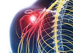 Shoulder Pain