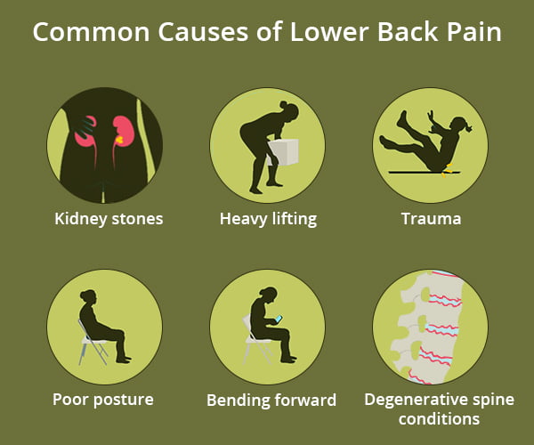 Lower Back Pain: Symptoms, Causes, Treatment, and Stretches