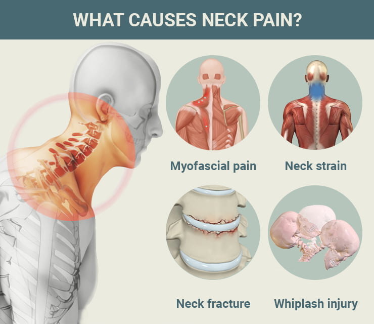 The Different Types of Neck Pain and the Causes : Maryland Pain & Wellness  Center: Pain Management