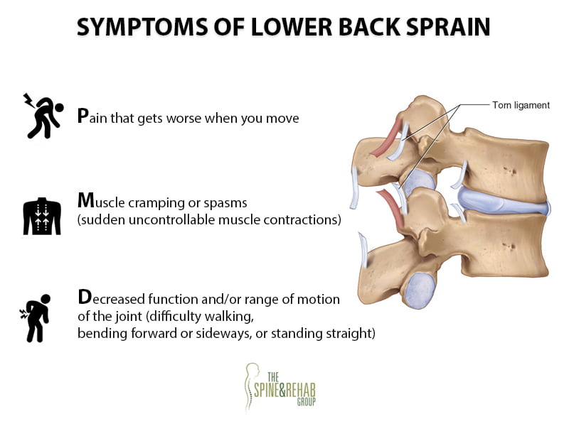 Lumbar Sprain/Lower Back Sprain NJ & NYC