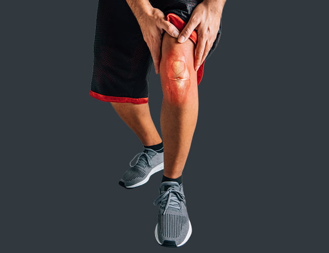 Knee Injuries