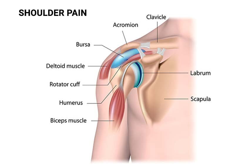 Get the Right Doctor for Neck and Shoulder Pain