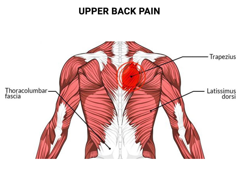 Upper Back Pain Doctors NJ & NYC