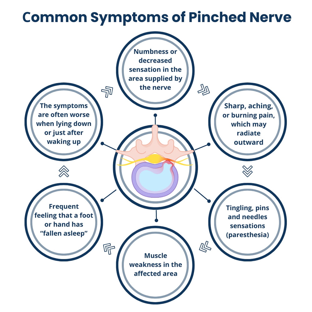 Common Symptoms of Pinched Nerve