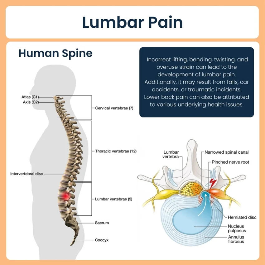 Lumbar pain sales