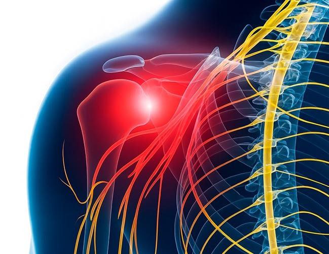 Shoulder Pain